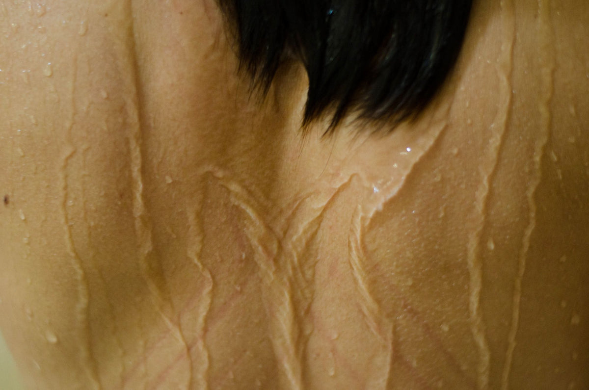 skin-context macro