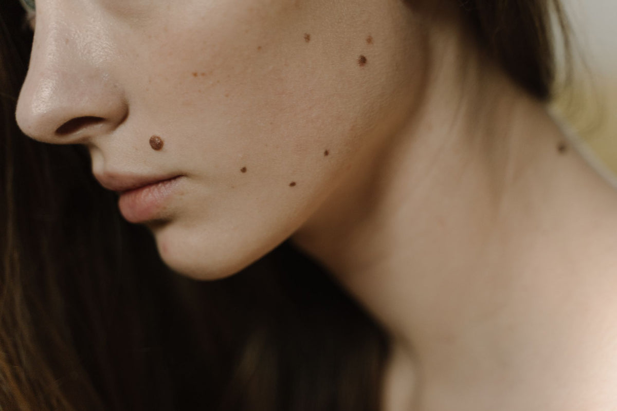 skin-context macro
